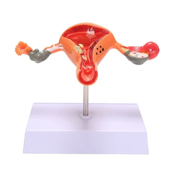 Gimdos, Kiaušidžių Modelis Modelis Anatomija Moterų Reprodukcinių Organų Modelis Rodo, Gimdos, Kiaušidžių Makštį, Gimdos Mokymo